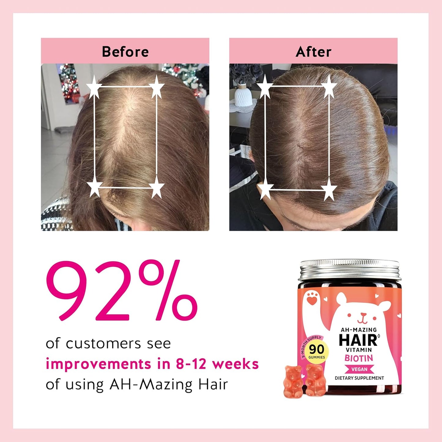 Biotin Gummies for Hair